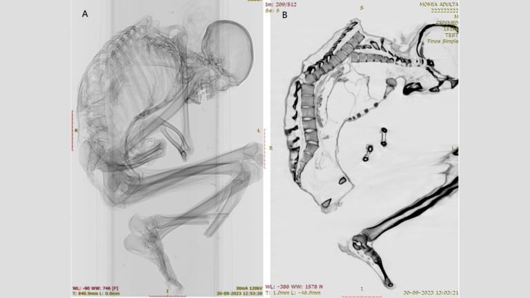 1,100-year-old mummy found in Chile died of extensive injuries when a turquoise mine caved in, CT scans reveal